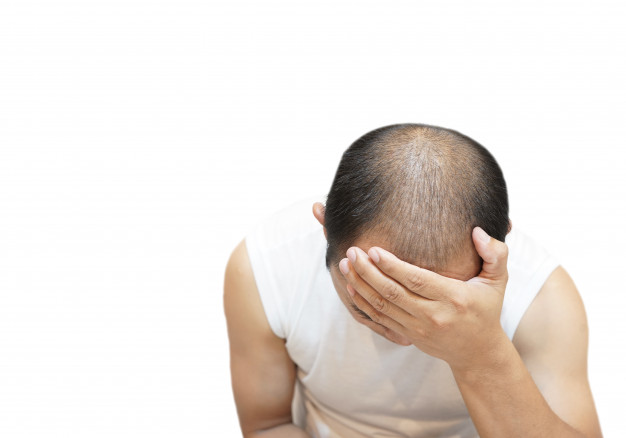 hair loss stress